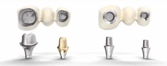 dental implant abutments 